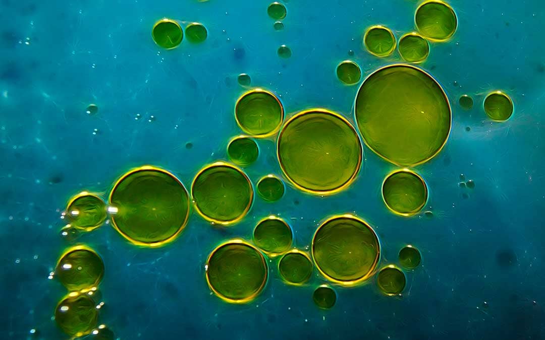 El aceite de oliva eficaz frente a células madre cancerígenas.